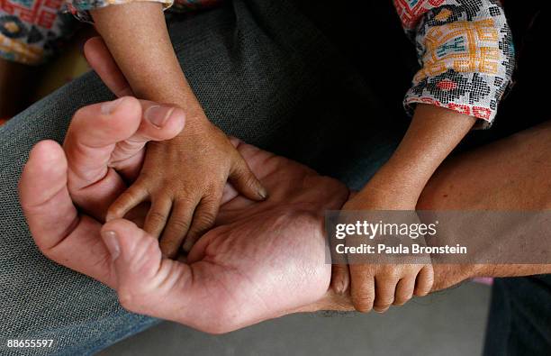 Khagendra Thapa Magar, 15 and a half, holds the hand of a fully grown adult friend on March 13, 2007 in Pokhara, Nepal. According to the Guinness...