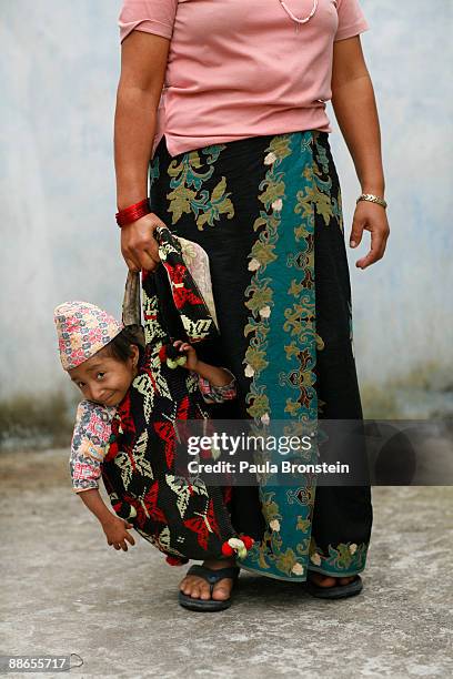 Khagendra Thapa Magar, 15 and a half, fits into a handbag held by his mother Dhan Maya on March 13, 2007 in Pokhara, Nepal. According to the Guinness...