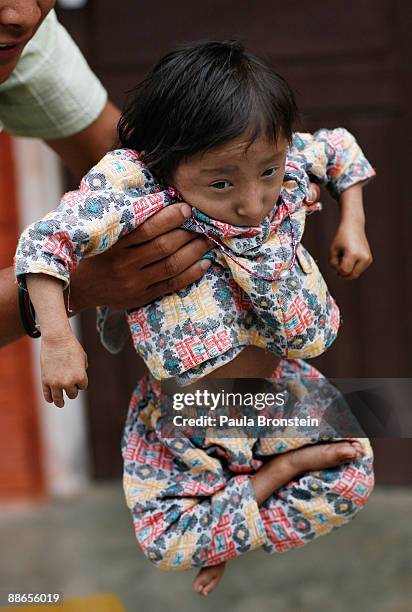Khagendra Thapa Magar, 15 and a half, is carried by a family member on March 13, 2007 in Pokhara, Nepal. According to the Guinness World Book of...