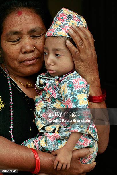 Khagendra Thapa Magar, 15 and a half, is held affectionately by Padamkali, a close family relative March 12, 2007 in Pokhara, Nepal. According to the...