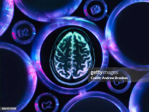 alzheimers and dementia research, a brain scan in multi well tray used for research experiments in laboratory - brain scan stock-fotos und bilder