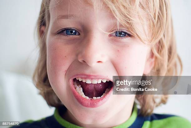 boy showing lost tooth, portrait - losing virginity - fotografias e filmes do acervo