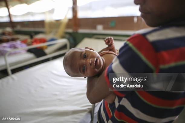 Rohingya baby, who fled from oppression within ongoing military operations in Myanmars Rakhine state, is seen as she waits to receive medical...