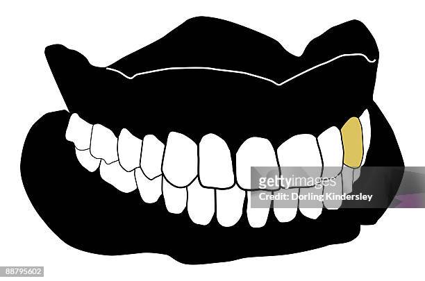 black and white digital illustration of set of dentures with gold tooth amid white teeth - トゥースキャップ点のイラスト素材／クリップアート素材／マンガ素材／アイコン素材
