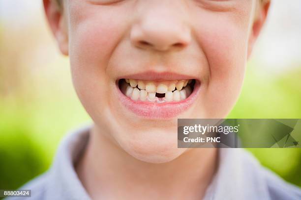 smiling kid with mising tooth - 歯を食いしばる ストックフォトと画像