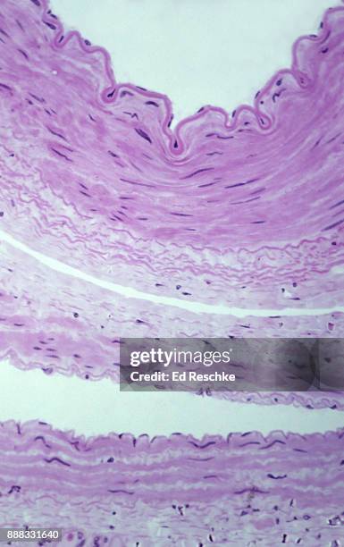 a comparison of an artery and vein showing the tunics (or layers) cross section, 50x - arteries stock pictures, royalty-free photos & images