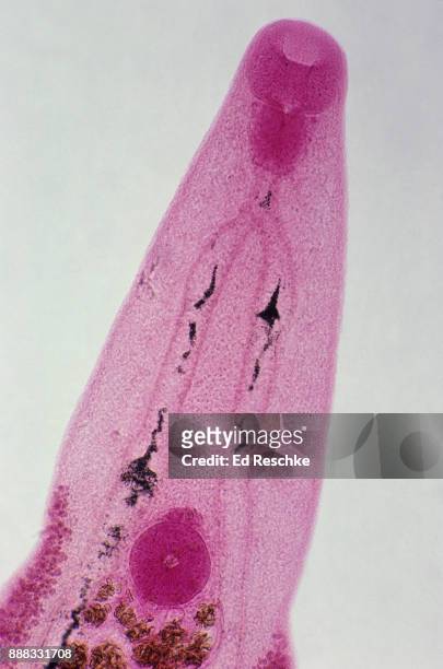 chinese liver fluke (clonorchis sinensis) a serious parasite in asia, 25x - faringe - fotografias e filmes do acervo