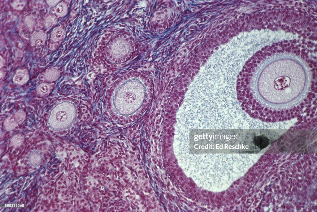 Primerial Primordial Follicle Model
