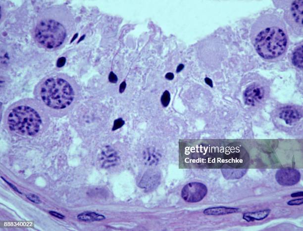 spermatogenesis (sperm production and development) seminiferous tubule, testis, human 250x - hodensack stock-fotos und bilder