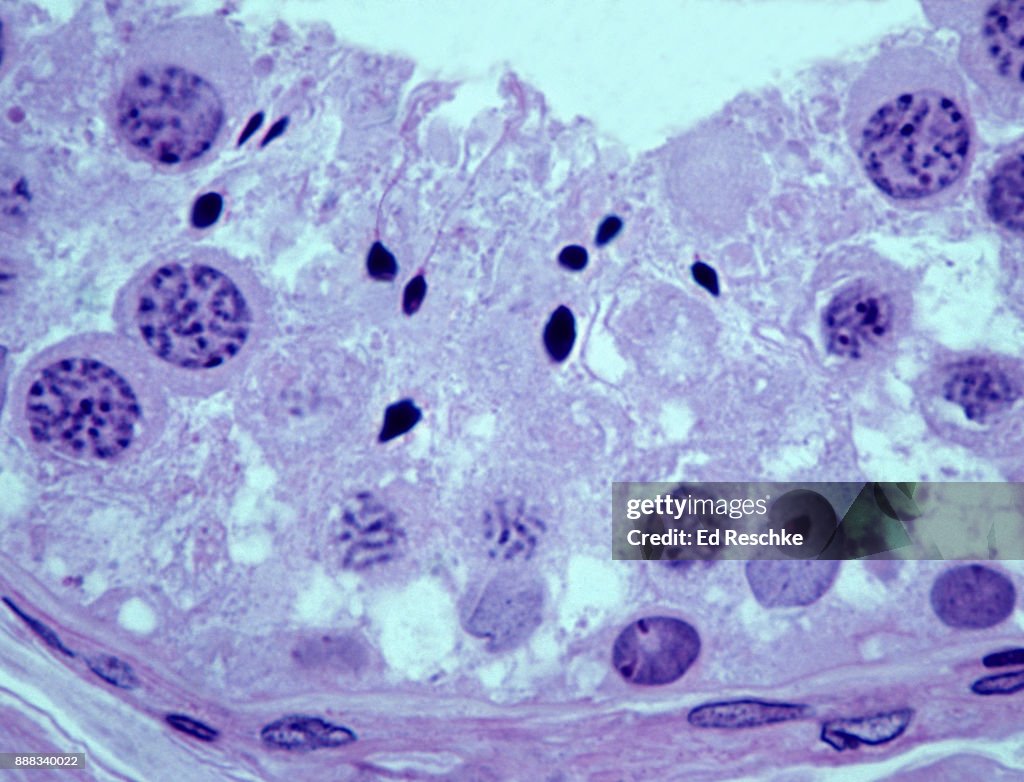 SPERMATOGENESIS (SPERM PRODUCTION and DEVELOPMENT) SEMINIFEROUS TUBULE, TESTIS, Human 250X
