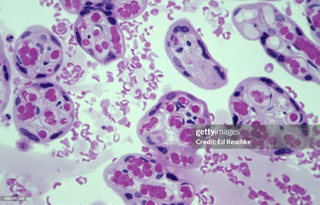PLACENTA--CHORIONIC VILLI, PLACENTAL MEMBRANE, FETAL CAPILLARIES and MATERNAL BLOOD POOLS, 100X