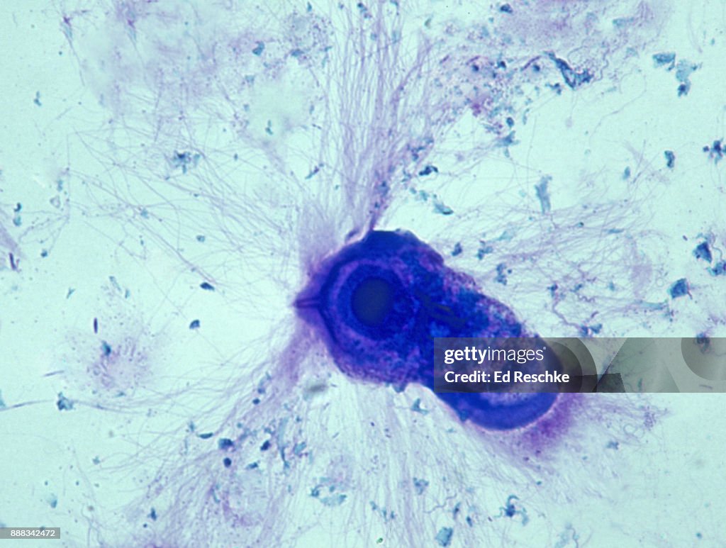 SYMBIOSIS--MUTUALISM, Protozoan in termite gut that digests wood, TRICHONYMPHA, 100X