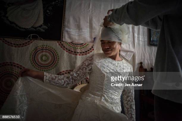 Barbie tries on a gown inside her friend's house on October 20, 2017 in Saguiaran, southern Philippines. Barbie is from Marawi city and suffers from...
