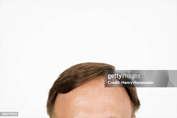 man's forehead and hair - forehead stock pictures, royalty-free photos & images