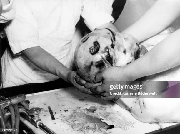 The autopsy of assassinated Russian revolutionary Leon Trotsky in Mexico City, 21st August 1940. Trotsky was murdered by NKVD agent Ramon Mercader...
