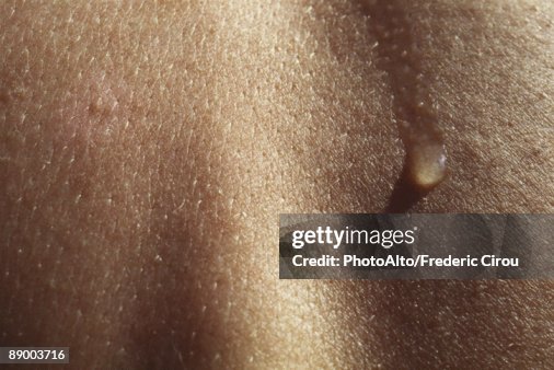 Perspiration on skin, extreme close-up Perspiration on skin, extreme close-up