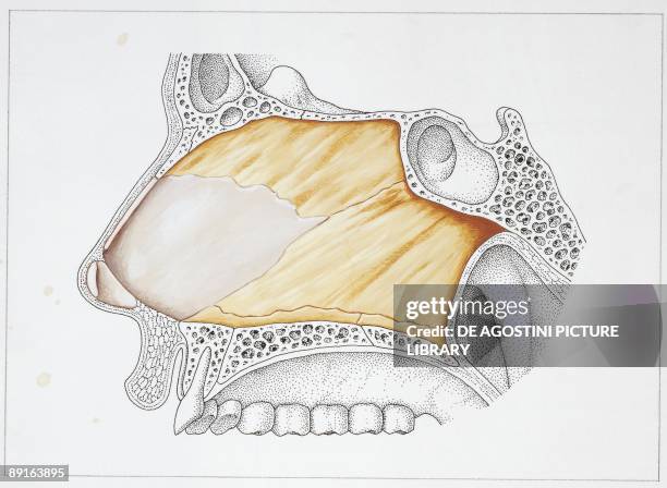 Illustration of nasal septum, bones and cartilage