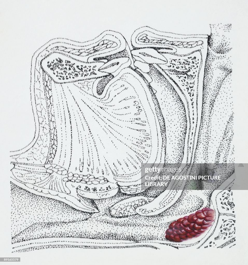 Illustration of adenoids