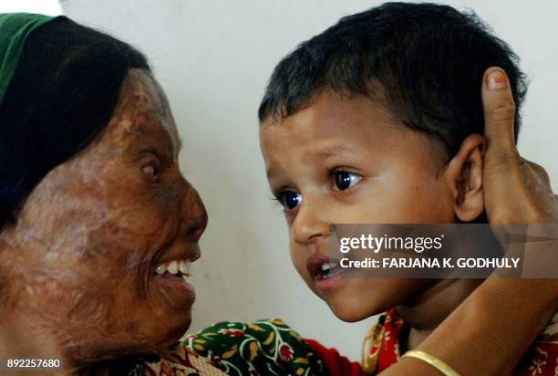 An acid victim mother embraces her daughter as she take part in an inauguration ceremony of the "Acid Survivors Convention" in Dhaka, 05 November...