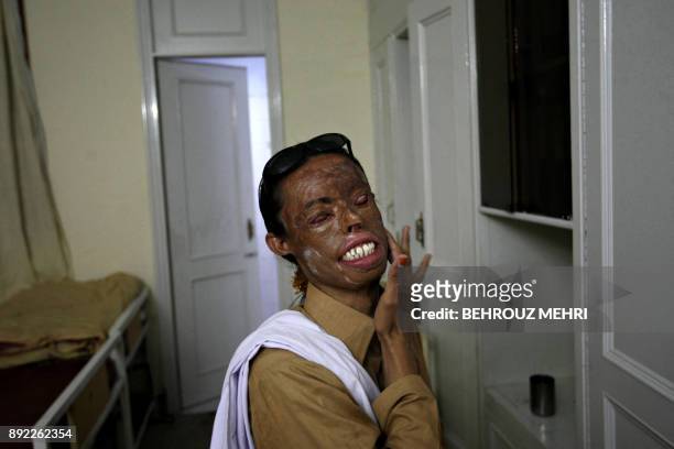 To go with French language story Pakistan-société-sexualité by Emmanuel DUPARCQ Pakistani eunuch and acid attack survivor Zafar Iqbal applies medical...