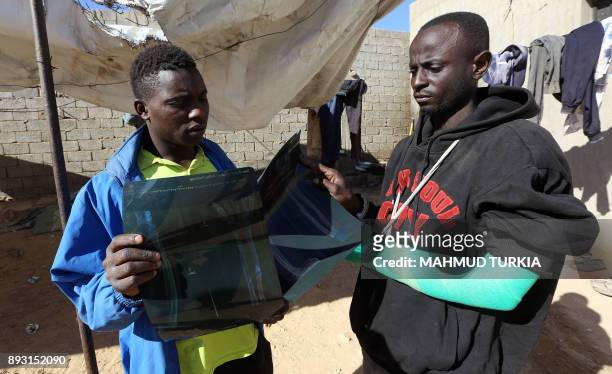 African migrants hold X-rays at a Safe House in the town of Bani Walid, on the edge of the desert 170 kilometres southeast of the Libyan capital...