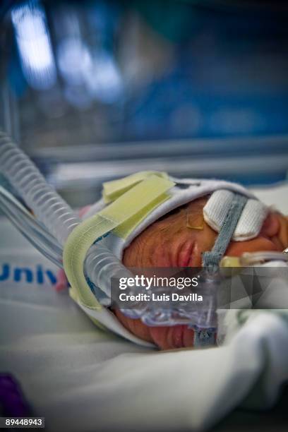 Premature Unit. La Paz Hospital. Madrid. Baby in incubator.