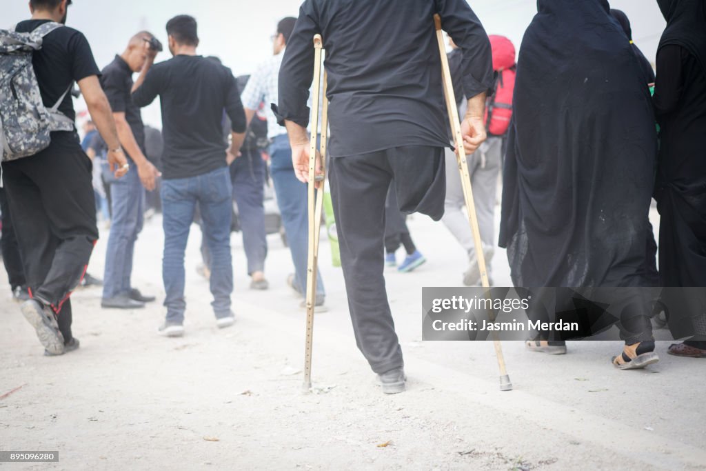 Man with amputee leg walking between people