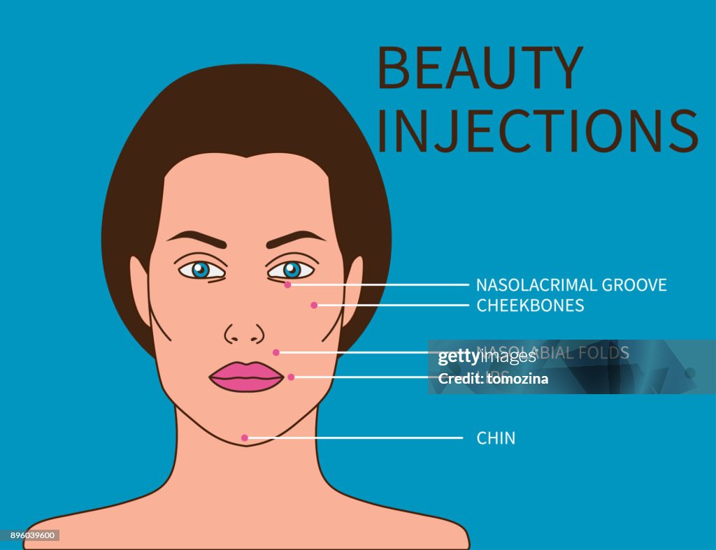 High Re Injection Scheme Of Beauty Injections High-Res Vector Graphic - Getty Images