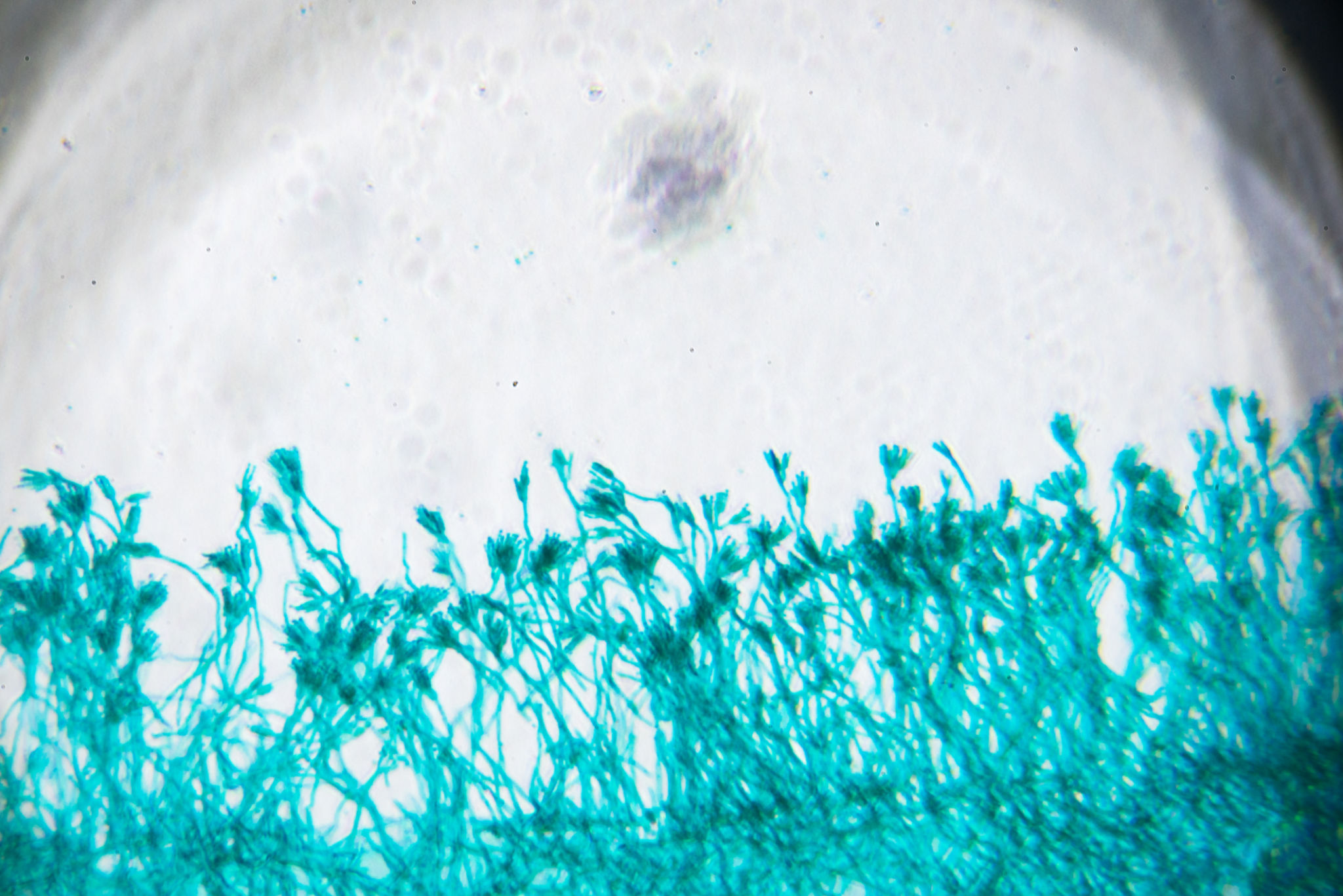 biomarkers discovery