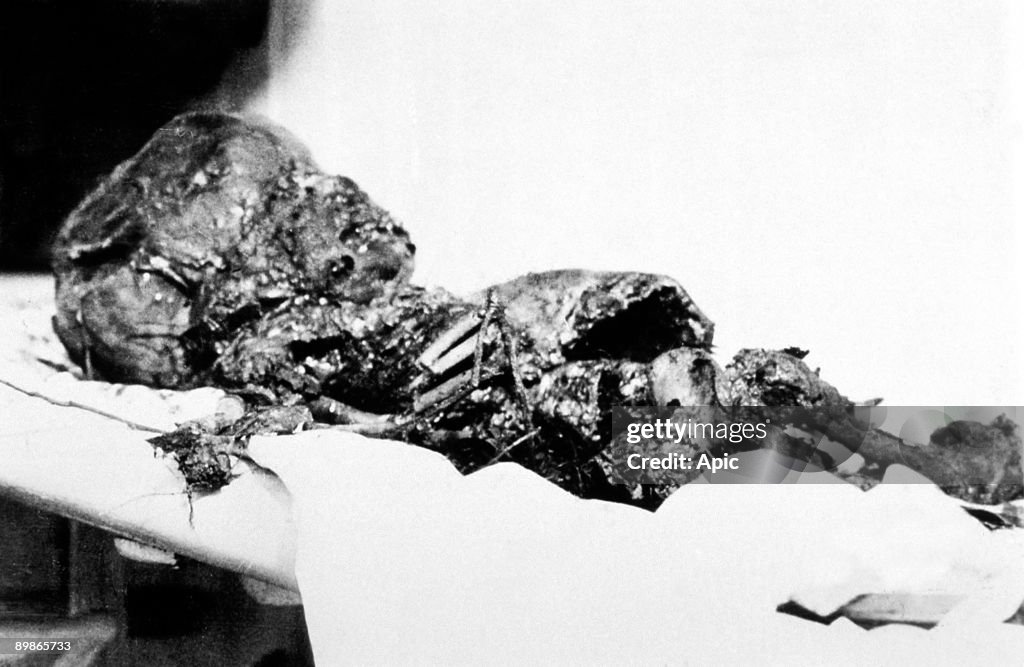 Lindbergh affair : body of Charles Jr Lindbergh, Ann Morrow and Charles Lindbergh's son, kidnapped and murdered by Bruno Richard Hauptmann, here after its discovery may 12, 1932