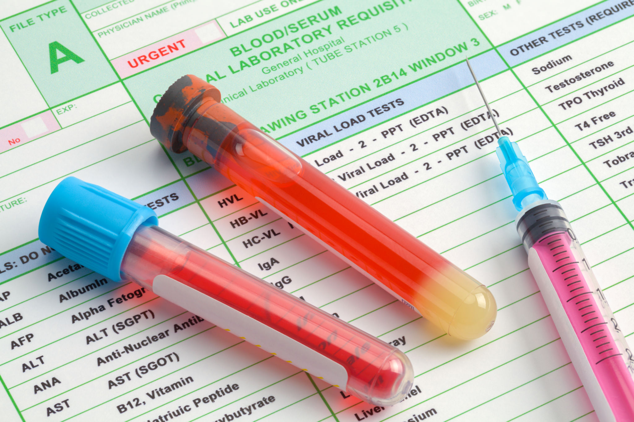 drug test results