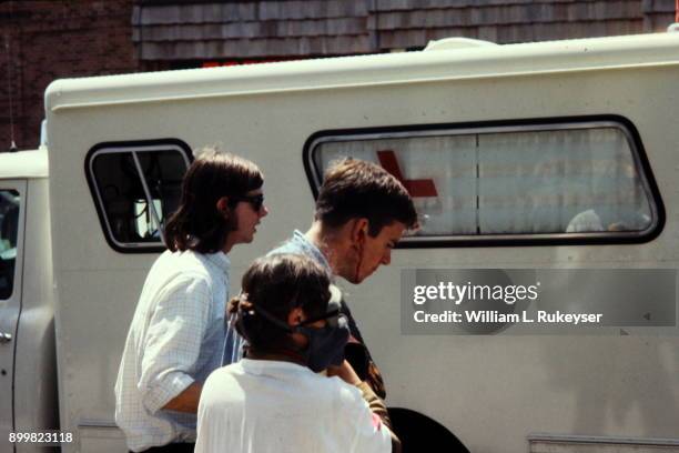 Wounded youth is escorted to a city ambulance.