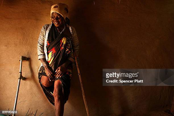 Mako Bakar Bakaro, who lost a leg in fighting in Mogadishu, Somalia in 2008, stands against the wall of her hut August 21, 2009 in Dadaab, the...