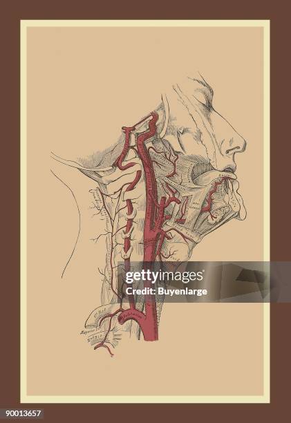 Internal Carotid Artery