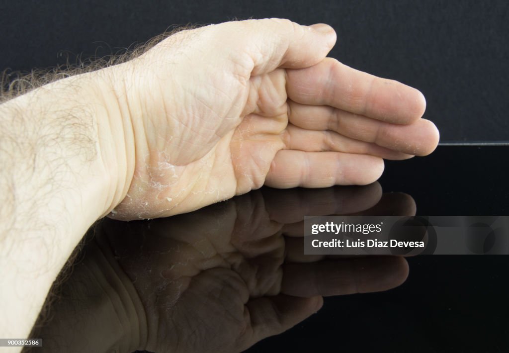 Man with cracked skin