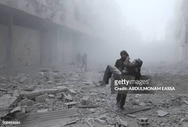 Wounded man is carried following an air strike on the rebel-held besieged town of Arbin, in the eastern Ghouta region on the outskirts of the capital...