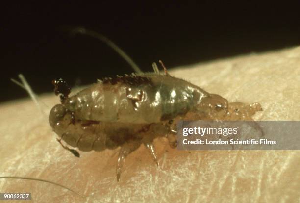 human head louse: pediculus humanus capitis  copulation - humanus capitis stock pictures, royalty-free photos & images