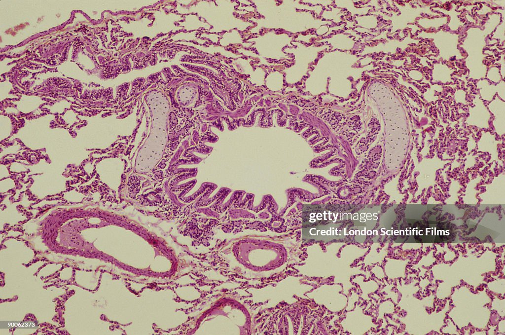 Healthy lung bronchus x 22