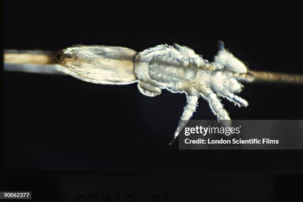 human head louse pediculus humanus capitis hatching egg - pediculosis capitis stock pictures, royalty-free photos & images