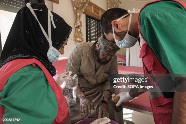 Ibrahim Bitar injured and burned by an airstrike. He lost his daughter and son a night before he could escape from Raqqa. His oldest son killed two...