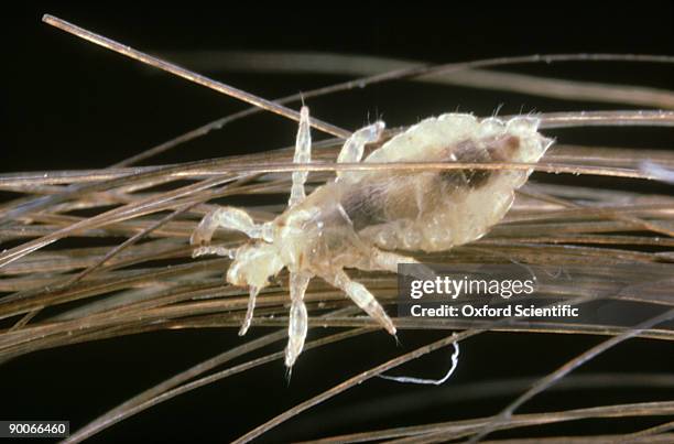 human head louse: pediculus humanus  on hair - animal hair fotografías e imágenes de stock