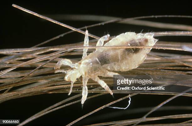 human head louse: pediculus humanus  on hair - シラミ ストックフォトと画像