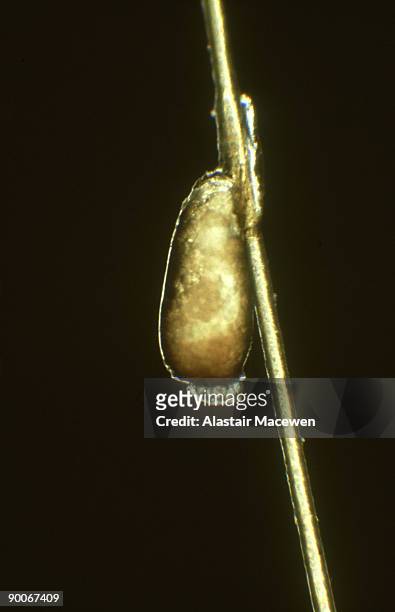 head louse: pediculus humanus capitis  egg on hair - humanus capitis stock pictures, royalty-free photos & images
