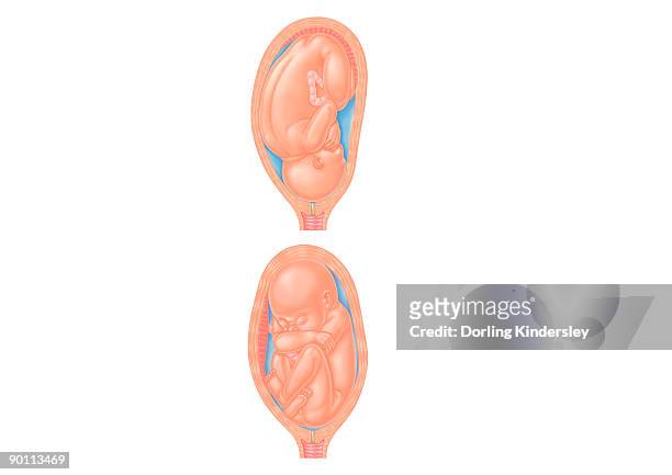 ilustraciones, imágenes clip art, dibujos animados e iconos de stock de cross section digital illustration of foetus in normal position and foetus in complete breech position with buttocks presented first - fetal position