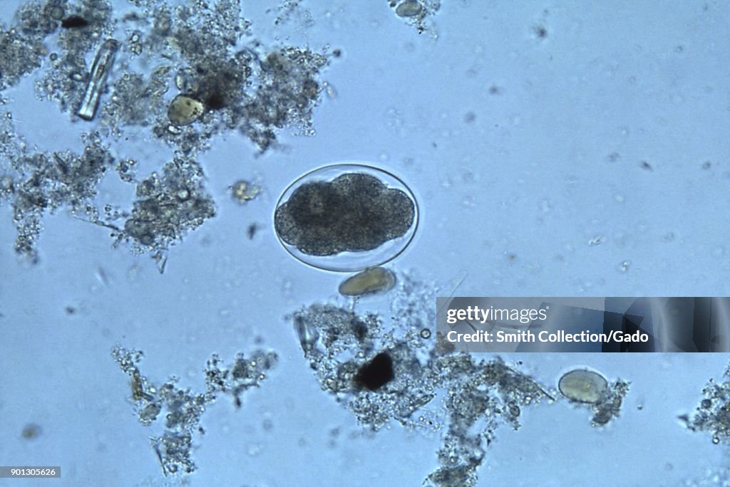 Hookworm Egg
