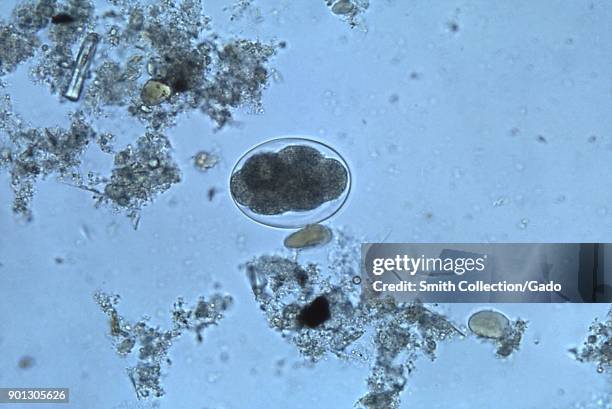 Embryophore 839 Tapeworm Stock Photos, High-Res Pictures, and Images - Getty Images