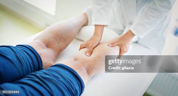 senior woman in a massage treatment. - vein stock pictures, royalty-free photos & images