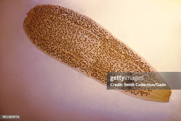 Photomicrograph of a proglottid from the flea tapeworm , resembling a rice grain, 1979. Image courtesy CDC.