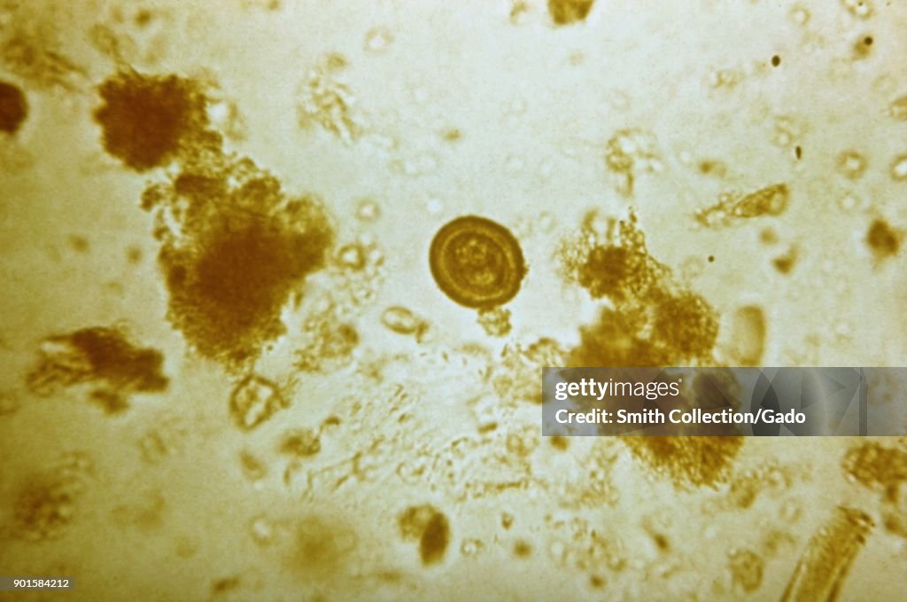 Embryophore Photomicrograph of a tapeworm egg, which causes the infections... News ...