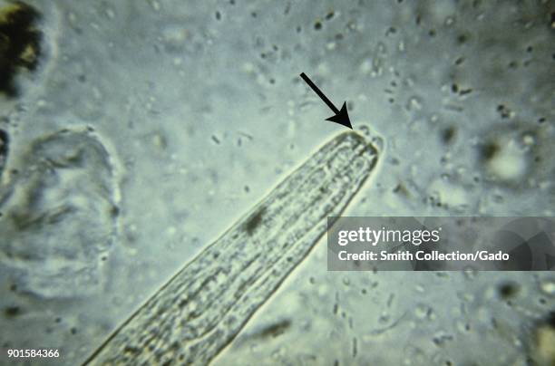 Photomicrograph with a detailed view of the short buccal cavity morphology in the rhabditiform larval stage of a Strongyloides species nematode ,...